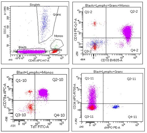 flow cytometry leukemia/lymphoma panel results|Flow Cytometry in the Diagnosis of Leukemias .
